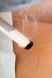 Moxa Treatment